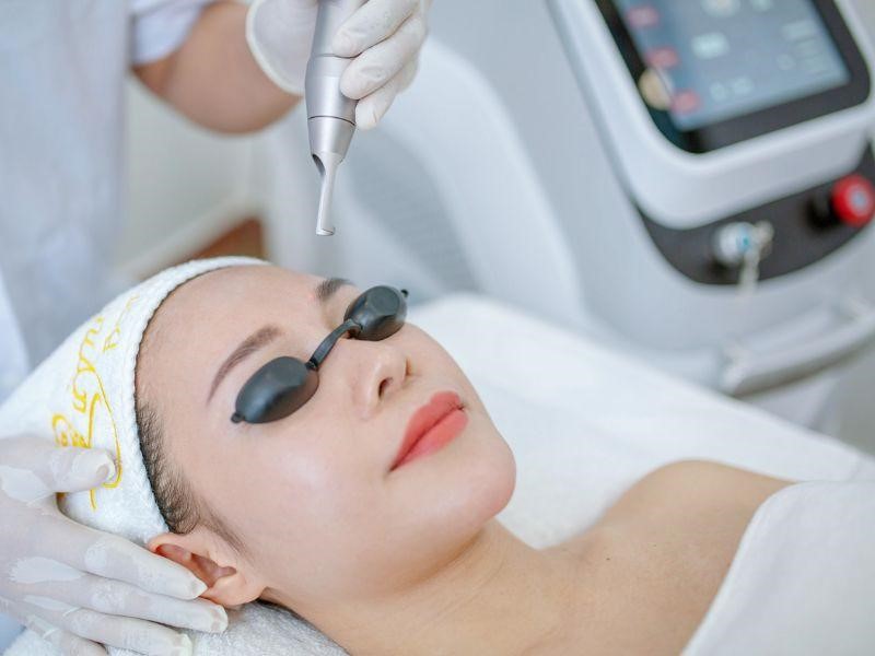 Địa Chỉ Dịch Vụ Xoá Sửa Laser Mày Môi Cũ Tại Pleiku